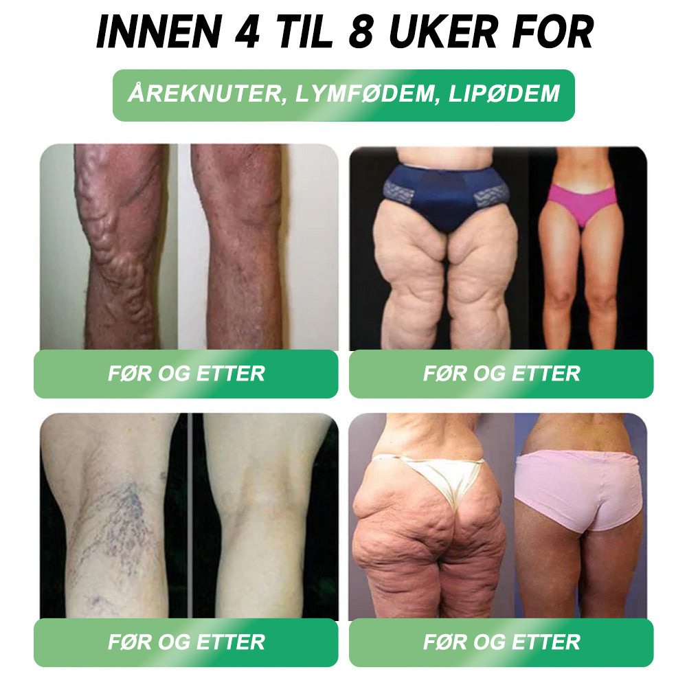 | Offisiell Butikk🏥 | 🇳🇴𝐏𝐄𝐀𝐊𝐀® 𝐺𝐿𝑃-𝟏 𝑺𝒊𝒙-𝒊𝒏-𝑶𝒏𝒆 𝑯𝒆𝒂𝒍𝒕𝒉 𝑺𝒐𝒍𝒖𝒕𝒊𝒐𝒏 𝑶𝒓𝒂𝒍 𝑳𝒊𝒒𝒖𝒊𝒅 (𝐁𝐚𝐫𝐞 𝐞́𝐧 𝐠𝐚𝐧𝐠 𝐨𝐦 𝐝𝐚𝐠𝐞𝐧, 𝐬𝐲𝐧𝐥𝐢𝐠𝐞 𝐟𝐨𝐫𝐚𝐧𝐝𝐫𝐢𝐧𝐠𝐞𝐫 𝐩𝐚̊ 𝟕 𝐝𝐚𝐠𝐞𝐫） ✅ For fedme, hjerte- og karsykdommer, diabetes, søvnapné, tarmhelse, leddproblemer og mer 💯